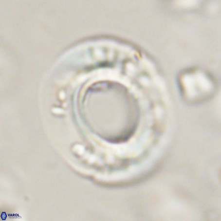 Reticulofenestra umbilicus VR 33930
