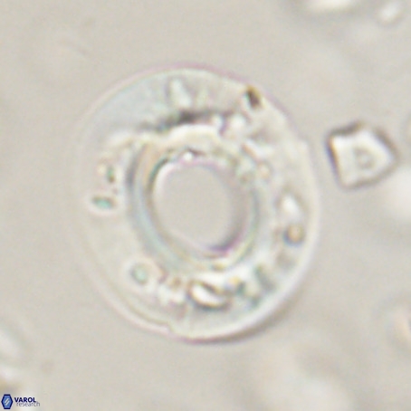 Reticulofenestra umbilicus VR 33931