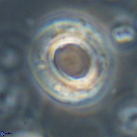 Reticulofenestra umbilicus VR 33932