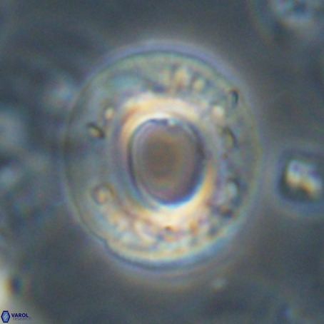 Reticulofenestra umbilicus VR 33933