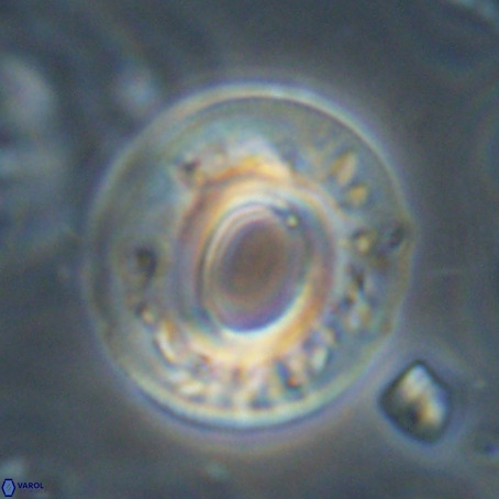 Reticulofenestra umbilicus VR 33934