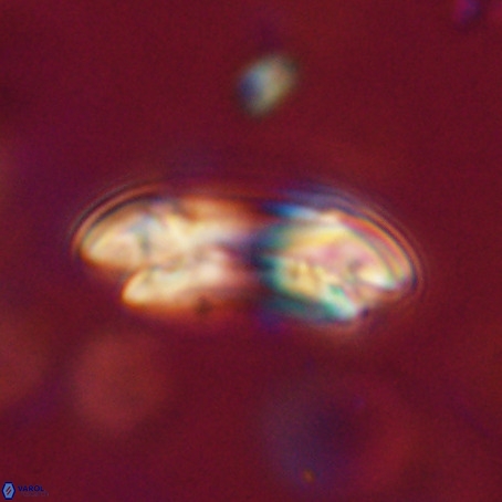 Reticulofenestra umbilicus VR 33935