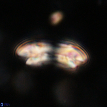 Reticulofenestra umbilicus VR 33936