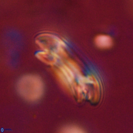 Reticulofenestra umbilicus VR 33938