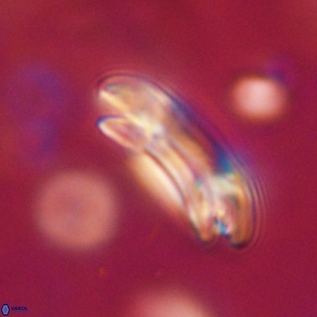 Reticulofenestra umbilicus VR 33939