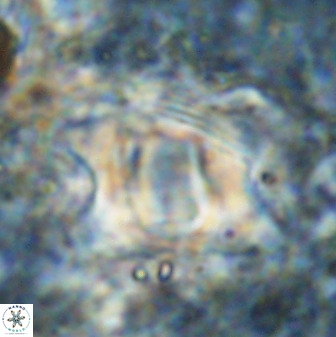 Rhomboaster bramlettei 49460