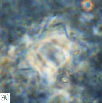 Rhomboaster bramlettei 49461