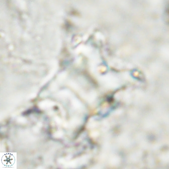 Rhomboaster bramlettei 49505