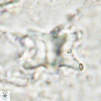 Rhomboaster bramlettei 49506