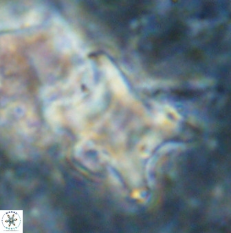 Rhomboaster bramlettei 49508