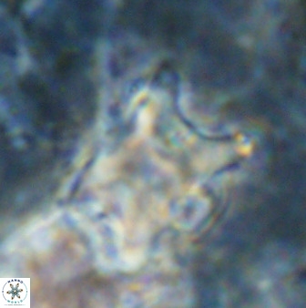 Rhomboaster bramlettei 49509