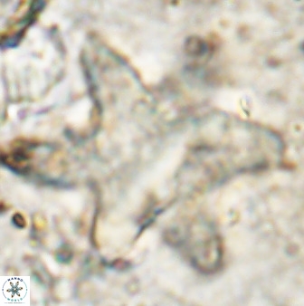 Rhomboaster bramlettei 49860
