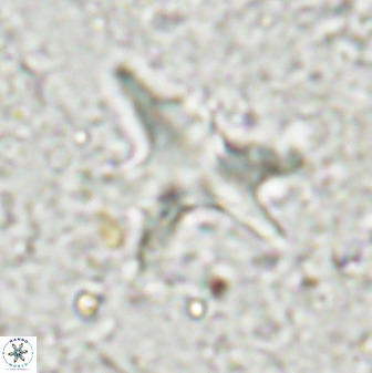 Rhomboaster contortus 49443