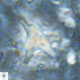Rhomboaster contortus 49444