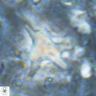 Rhomboaster contortus 49445