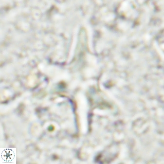 Rhomboaster contortus 49447