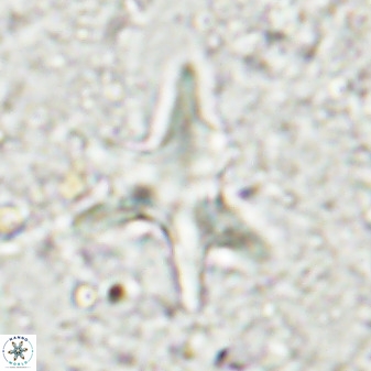 Rhomboaster contortus 49448
