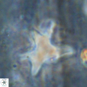Rhomboaster contortus 49360