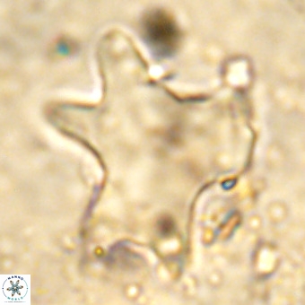 Rhomboaster contortus VR 00011