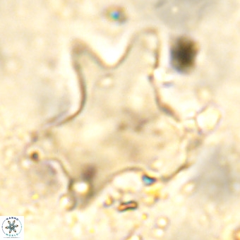 Rhomboaster contortus VR 00013