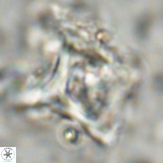 Rhomboaster cuspis 49427