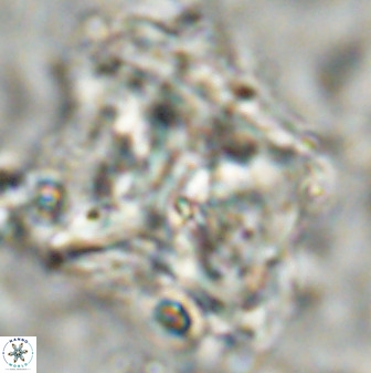 Rhomboaster cuspis 49428