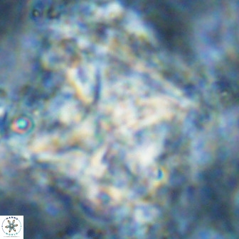 Rhomboaster cuspis 49429