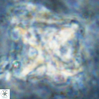 Rhomboaster cuspis 49430