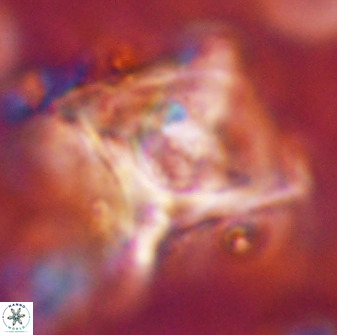 Rhomboaster cuspis 49431