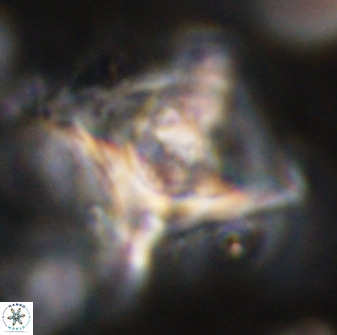 Rhomboaster cuspis 49432