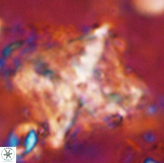 Rhomboaster cuspis 49434