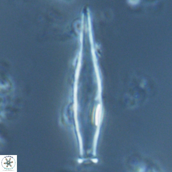 Rhabdosphaera inflata 25873