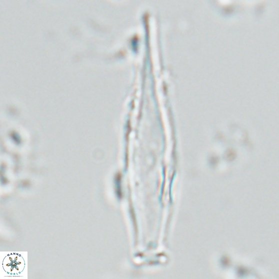 Rhabdosphaera inflata 25874