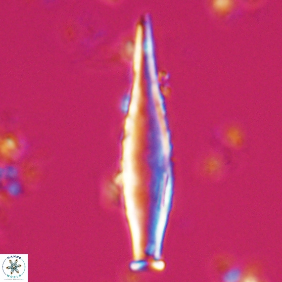 Rhabdosphaera inflata 25875
