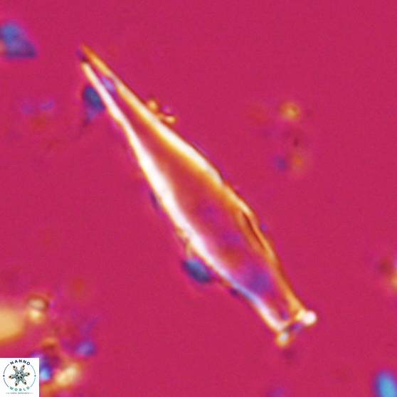 Rhabdosphaera inflata 25877