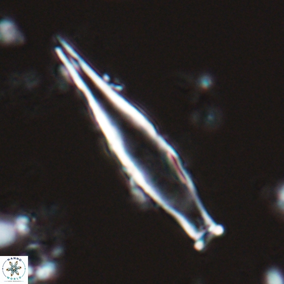 Rhabdosphaera inflata 25878