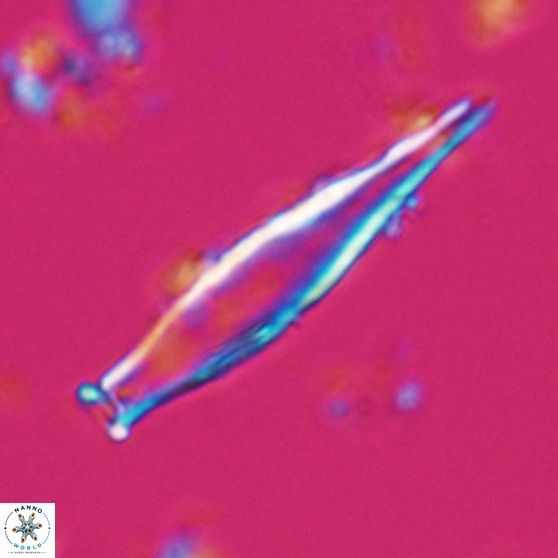 Rhabdosphaera inflata 25879