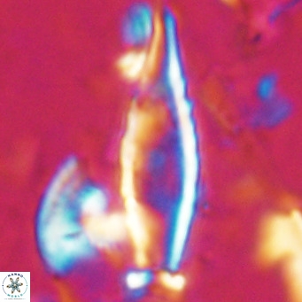 Rhabdosphaera inflata VR 025119