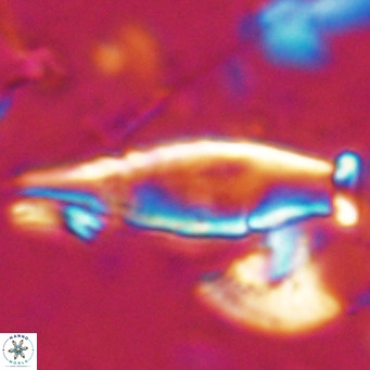 Rhabdosphaera inflata VR 025124
