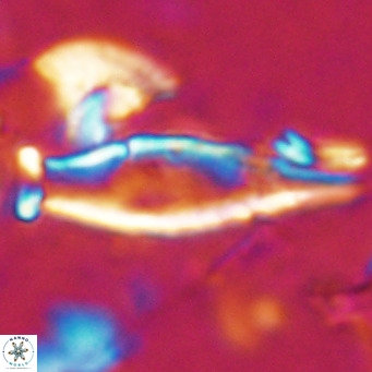 Rhabdosphaera inflata VR 025127