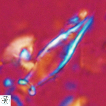 Rhabdosphaera inflata VR 025129