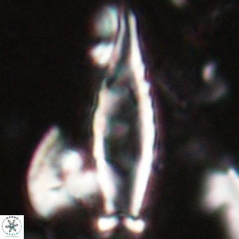 Rhabdosphaera inflata VR 025120