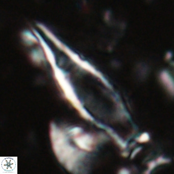 Rhabdosphaera inflata VR 025122