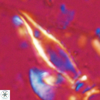 Rhabdosphaera inflata VR 025123