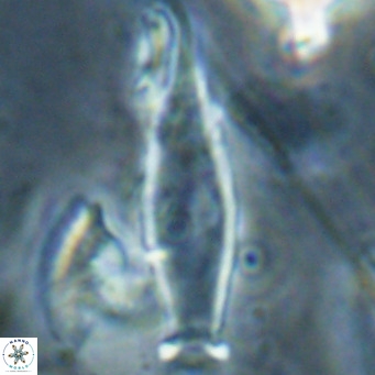 Rhabdosphaera inflata VR 025134