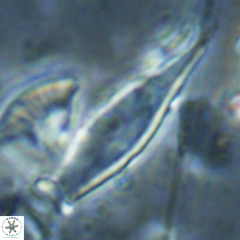 Rhabdosphaera inflata VR 025135