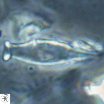 Rhabdosphaera inflata VR 025136