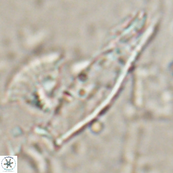 Rhabdosphaera inflata VR 025130