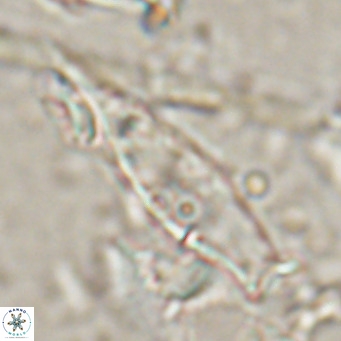 Rhabdosphaera inflata VR 025132