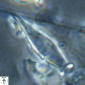 Rhabdosphaera inflata VR 025133